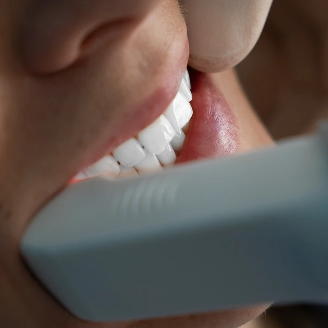 Masticazione corretta, Apparecchio ortodontico miofunzionale, relazione centrica
