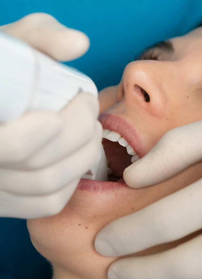 Morso Profondo, tecnologie